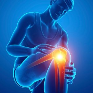 NYC top arthroscopic knee surgeon