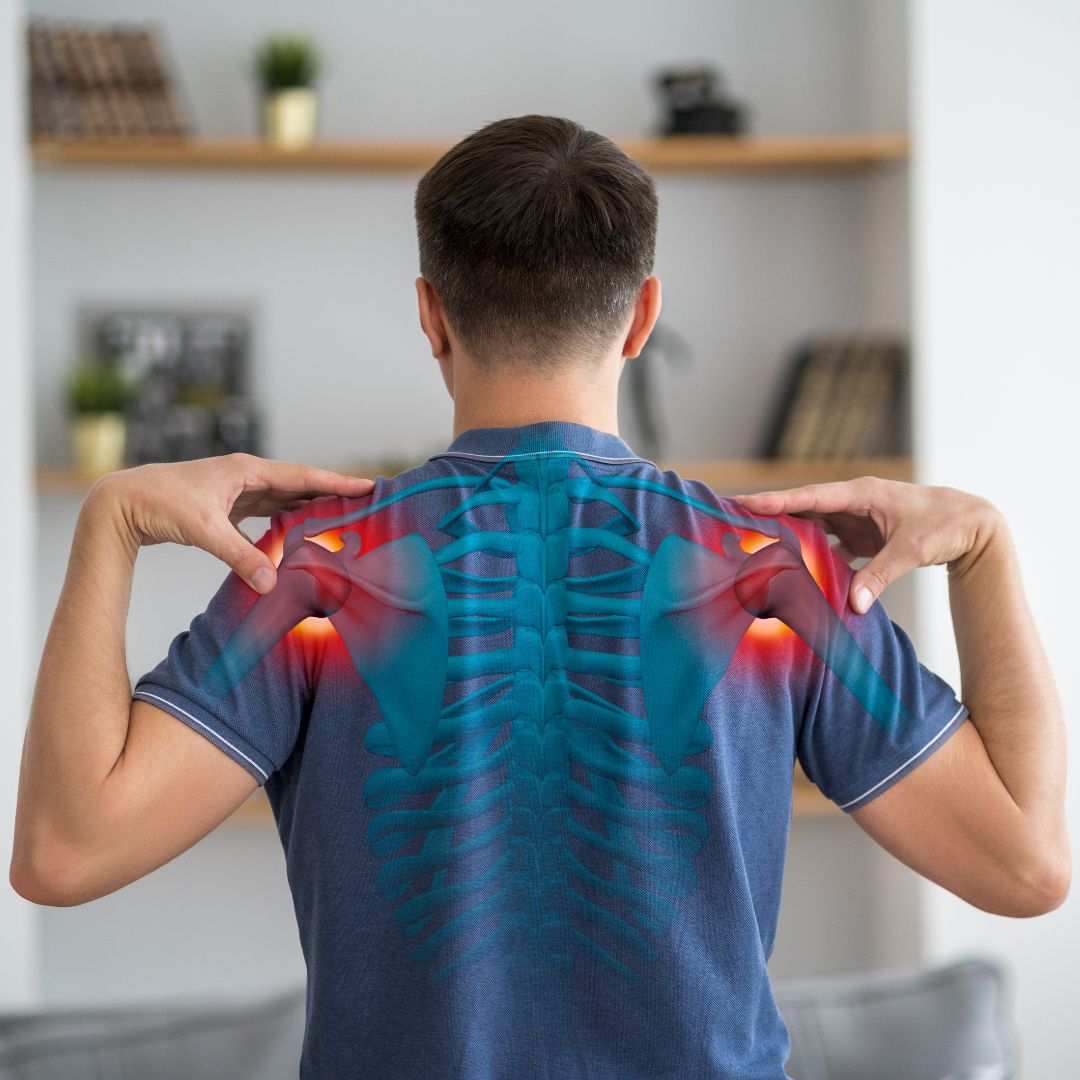 Understanding Shoulder Impingement Syndrome